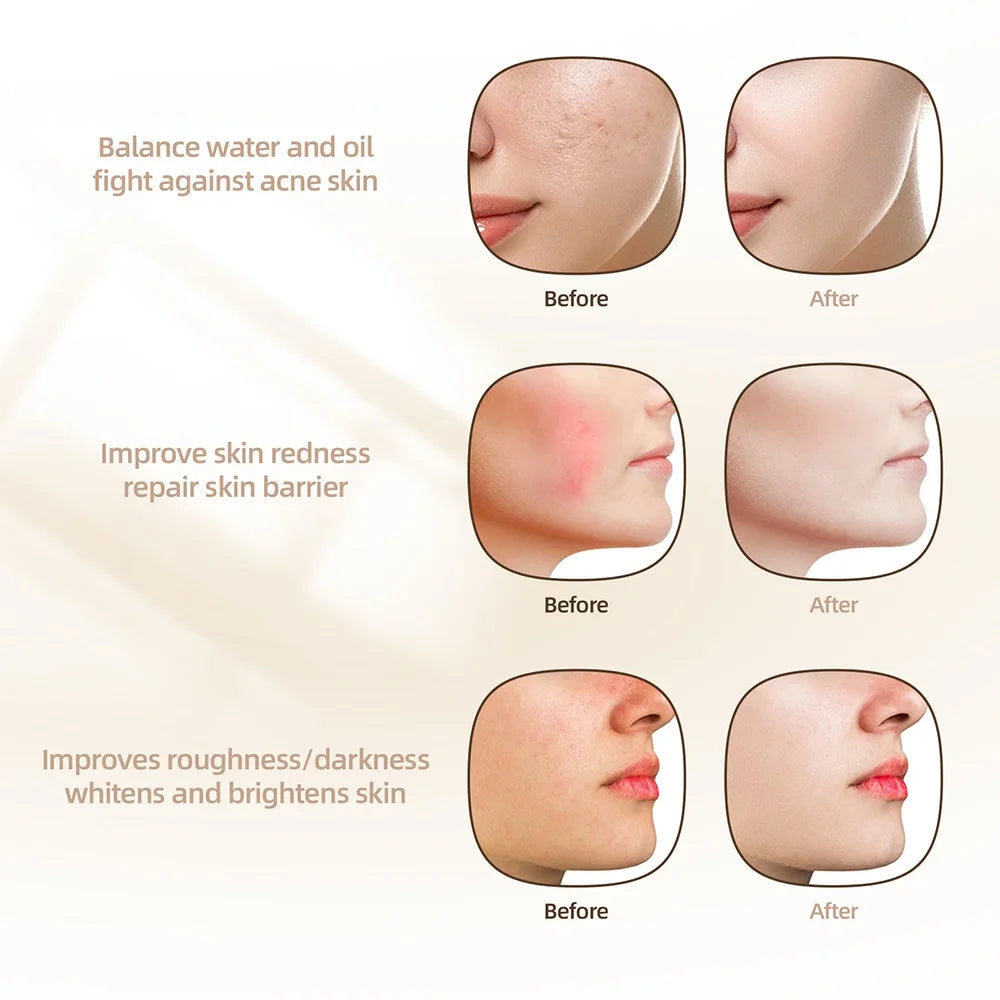 7 Colors Photon Silicone Face LED Mask 3D Facial Beauty Mask Red Light Therapy Skin Care Repair Skin Brightening Wireless Use