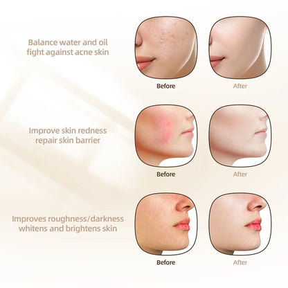 7 Colors Photon Silicone Face LED Mask 3D Facial Beauty Mask Red Light Therapy Skin Care Repair Skin Brightening Wireless Use